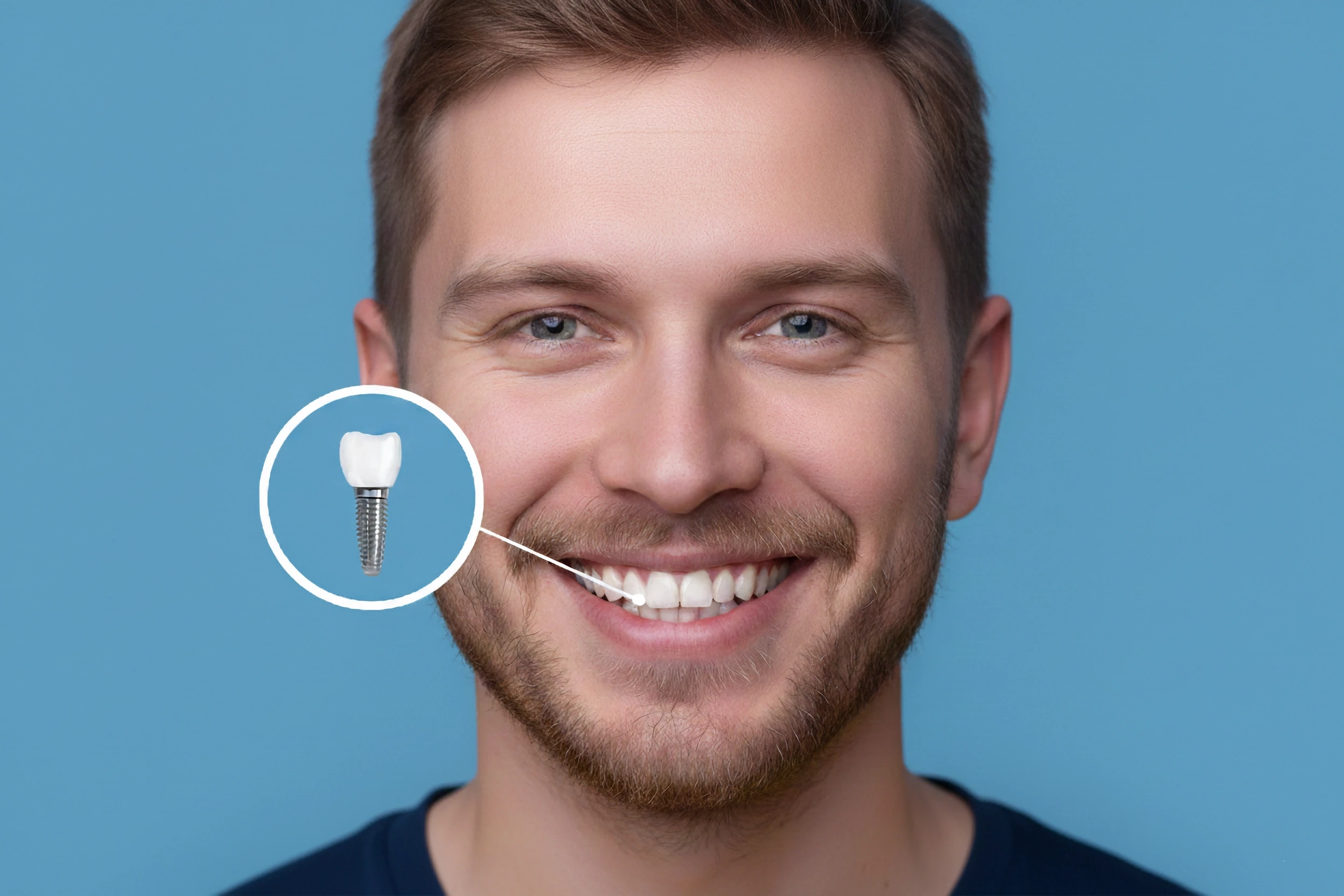 Instalacja implantu zębowego w Turcji
