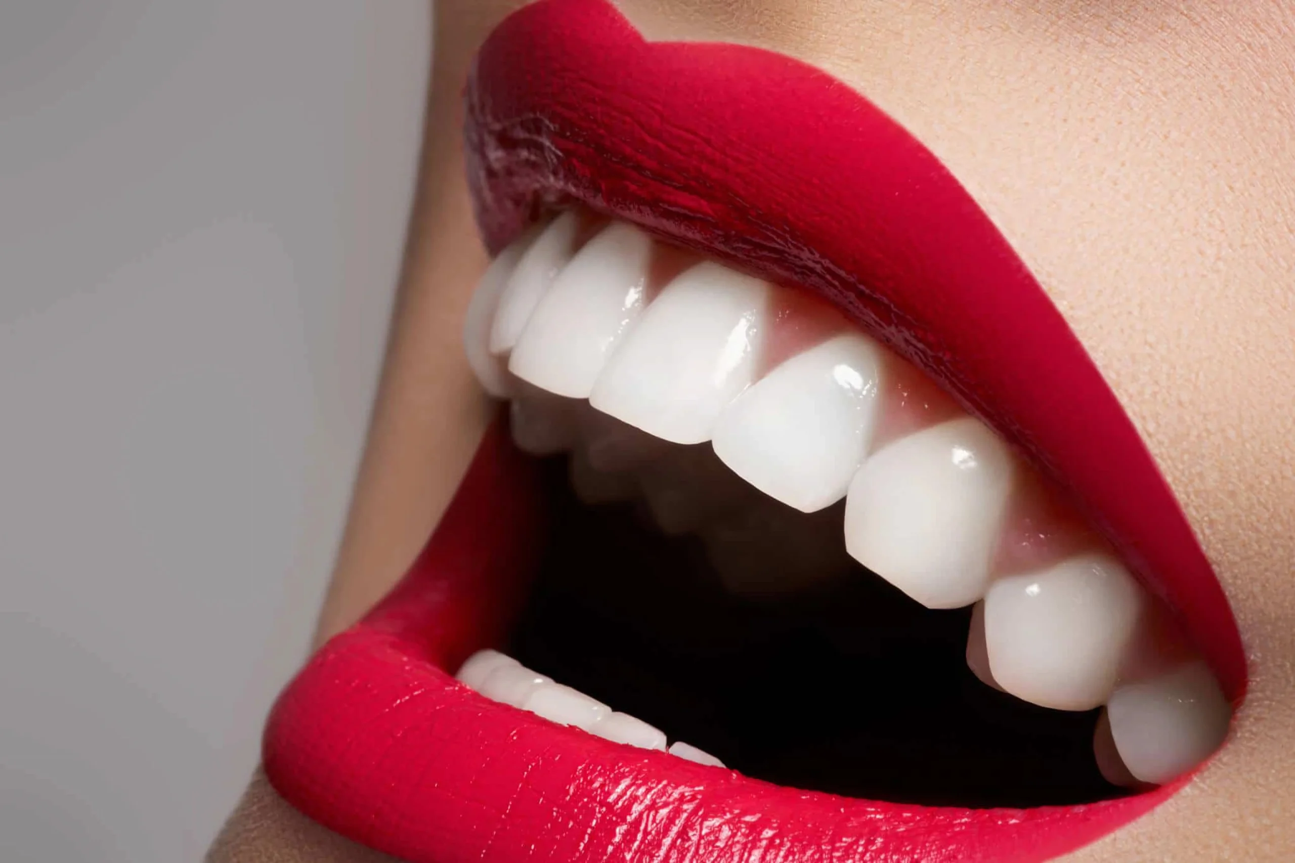 Jak wyglądają zęby po zabiegu Hollywood Smile w Turcji