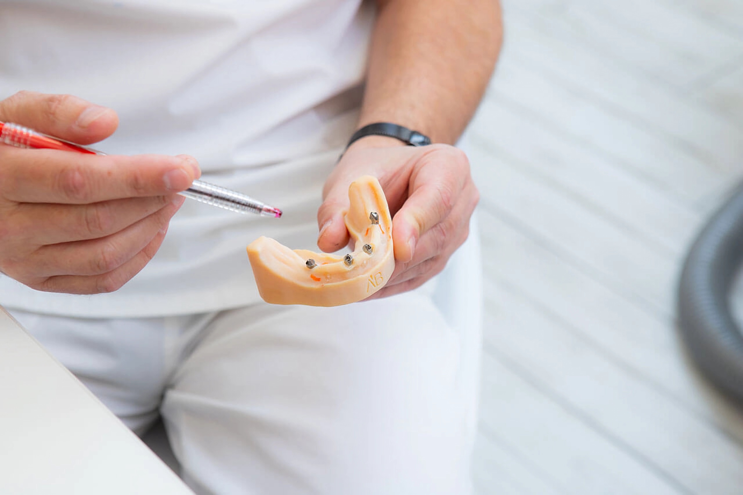 Zalety implantacji zębów All-on-4 w Turcji